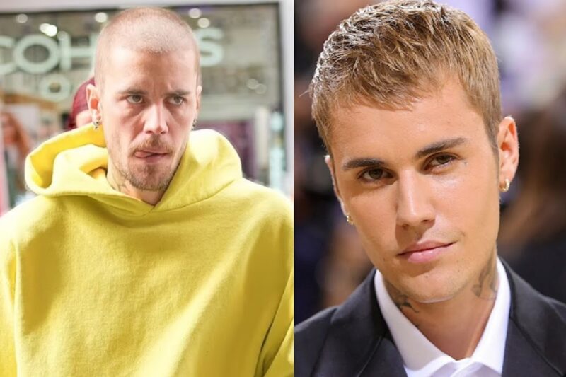 Scruffy Justin Bieber: ஜஸ்டின் பீபரா இது: எப்படி இருந்த நான் இப்படி ஆகிட்டேன் பாலியல் நோய் காரணமா ?